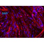 iXCellsΓäó Human iPSC-Derived Myoblasts